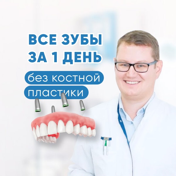 Метод Все на 4
